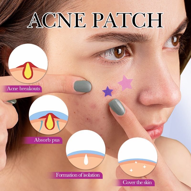 7/10/14Pcs Colorful Star Acne  - Skincare Qv ulasan dan harga