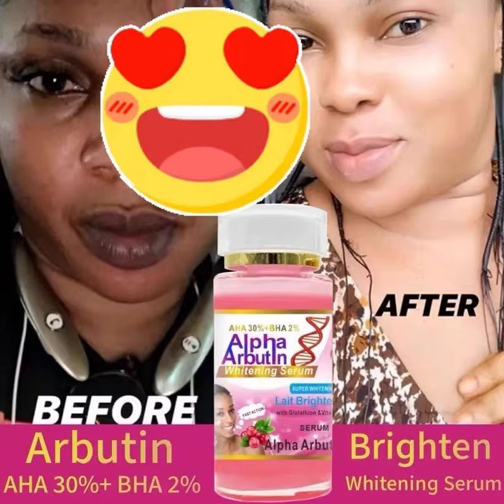 Alpha Arbutin Serum AHA 30%+ B - Alpha Arbutin Serum ulasan dan harga