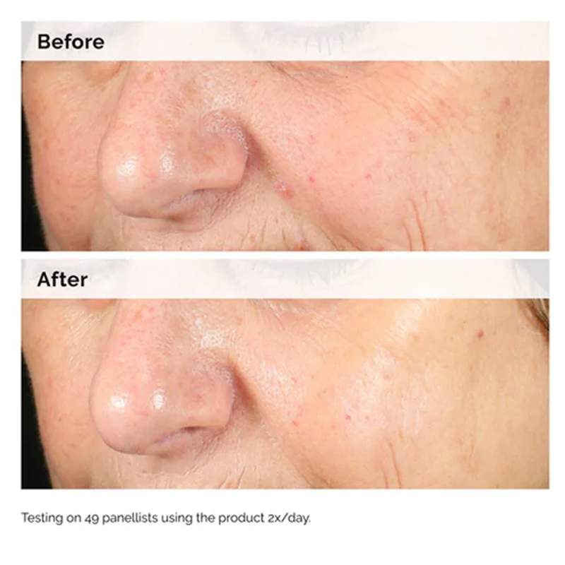 Alpha Arbutin 2% + HA 30ml Ser - Alpha Arbutin Serum ulasan dan harga