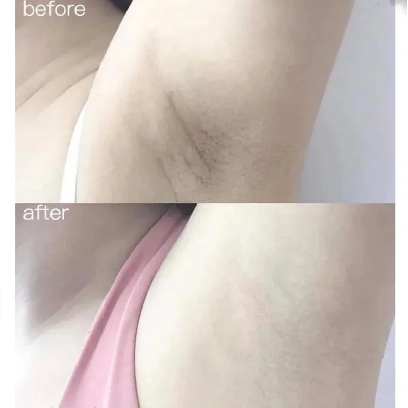 100ml Alpha Arbutin Collagen W - Alpha Arbutin Serum ulasan dan harga